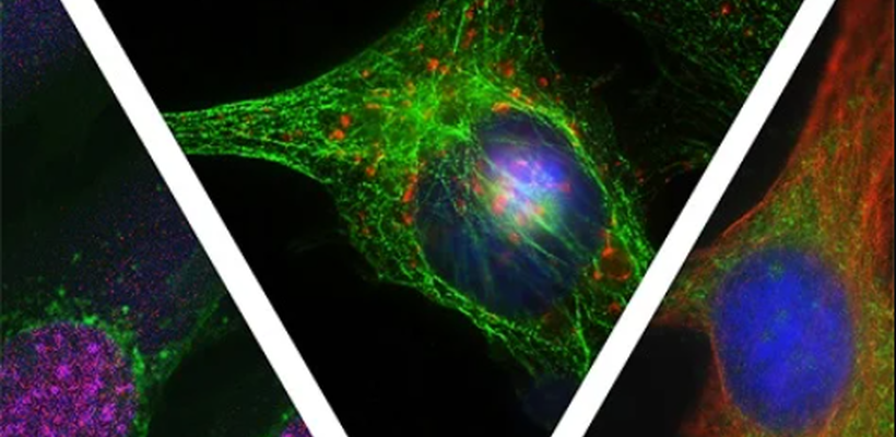 Ένα πρωτότυπο ημερολόγιο γραφείου έχει εκδώσει το Ινστιτούτο Νευρολογίας και Γενετικής Κύπρου (ΙΝΓΚ), για φιλανθρωπικό σκοπό προς ενίσχυση του Telethon.  