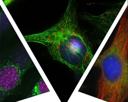 Ένα πρωτότυπο ημερολόγιο γραφείου έχει εκδώσει το Ινστιτούτο Νευρολογίας και Γενετικής Κύπρου (ΙΝΓΚ), για φιλανθρωπικό σκοπό προς ενίσχυση του Telethon.  