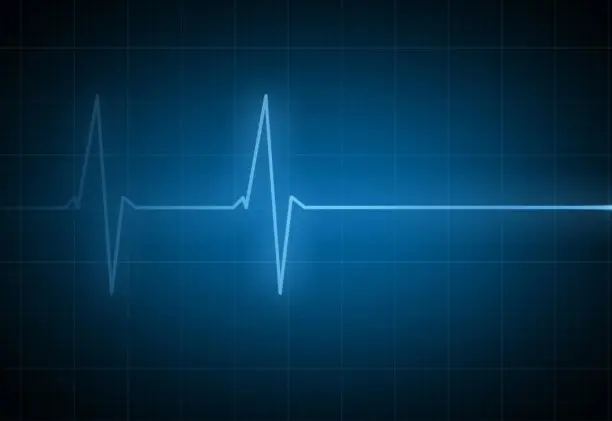 Αντιδρούν για ευθανασία ΠΙΣ και Οργανωμένοι Ασθενείς - «Προηγούνται άλλα»